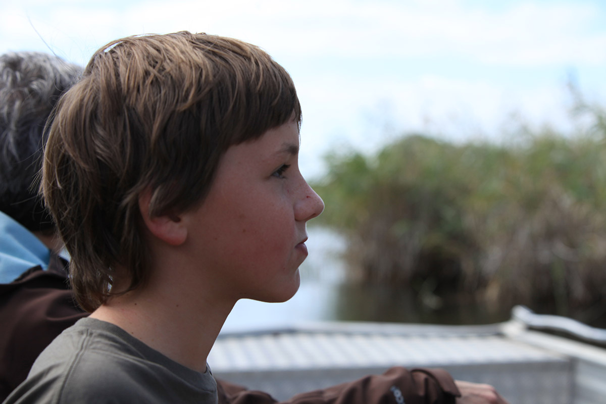 Sammy after getting hooked by fishing lure in Africa