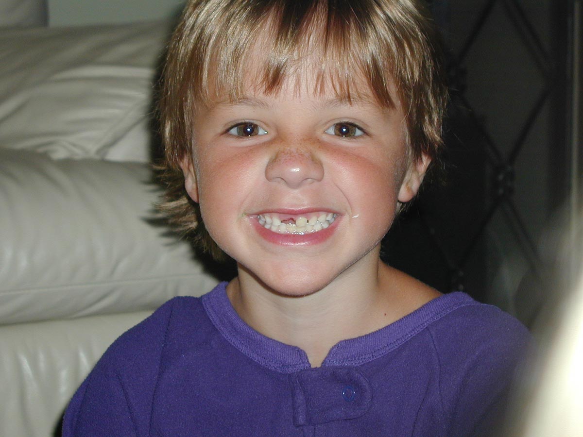Toothless Sammy